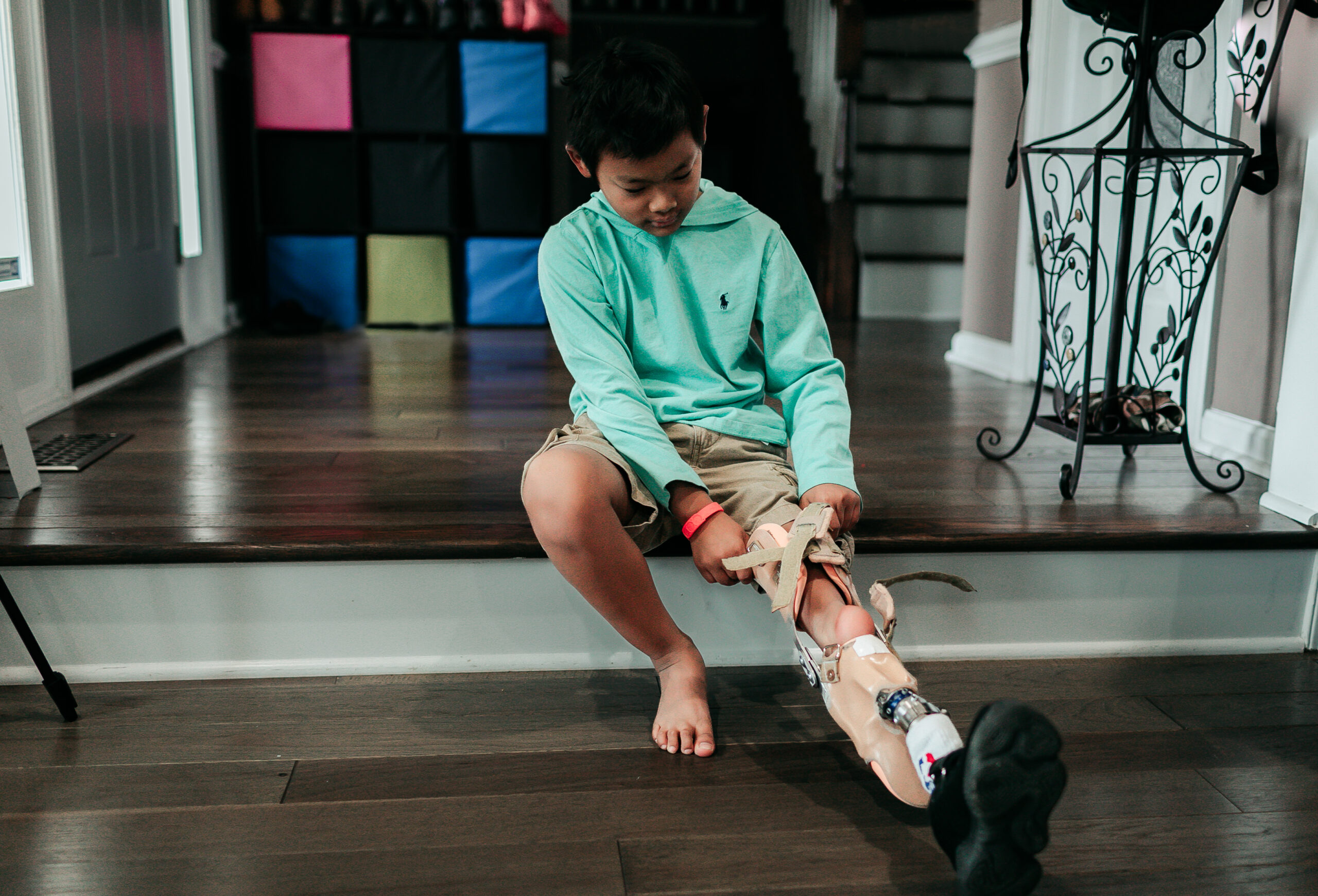 A boy sits on the steps he is putting on a prosthetic leg
