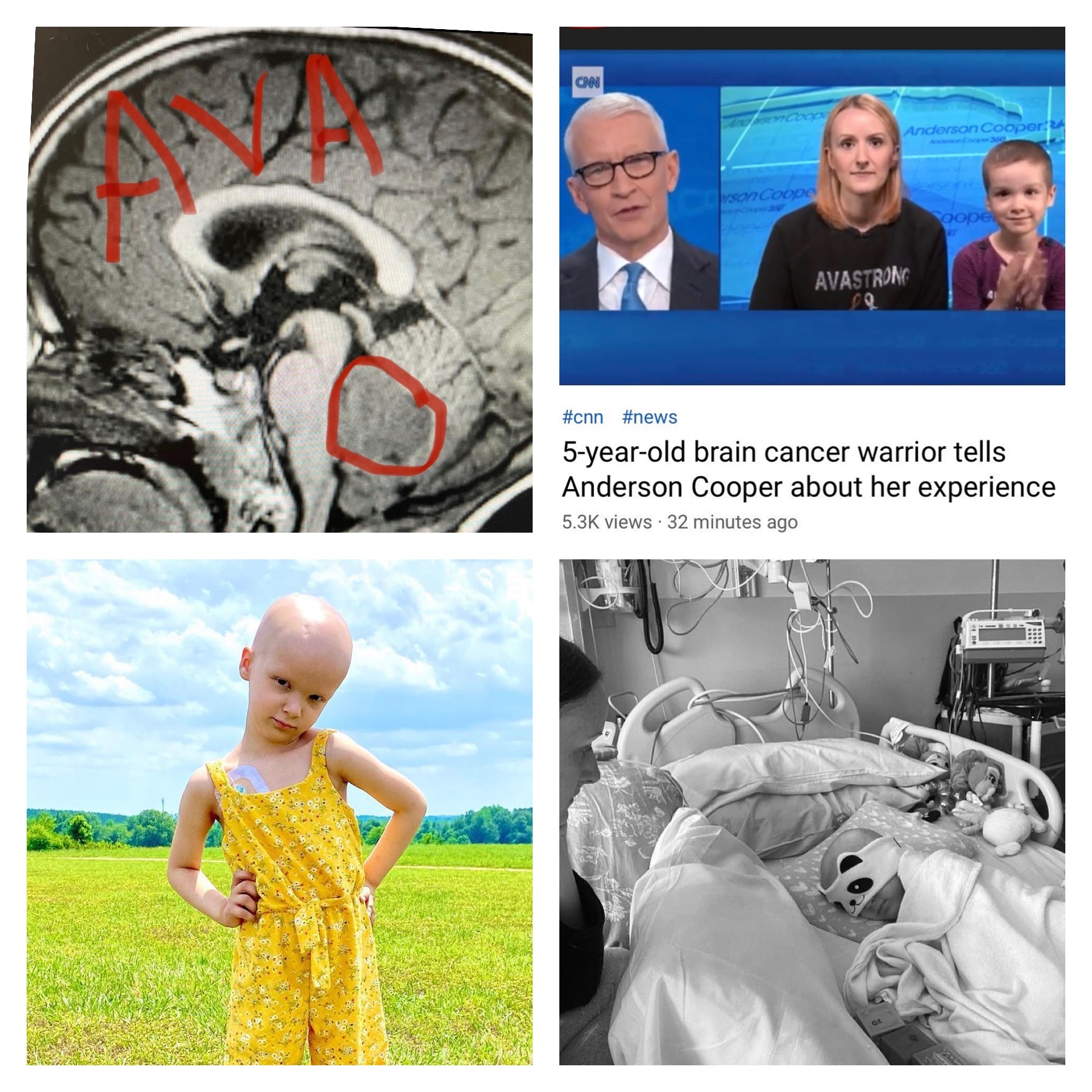 Collage of photos of Ava during her cancer treatment